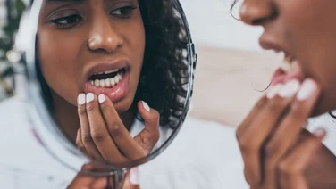 What to do if your filling falls out - featured. Woman's reflection in small mirror as she examines her teeth with pained expression