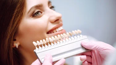 How to remove teeth stains - featured. Close up of a dentist's hands holding up a tooth shade guide against a woman's teeth