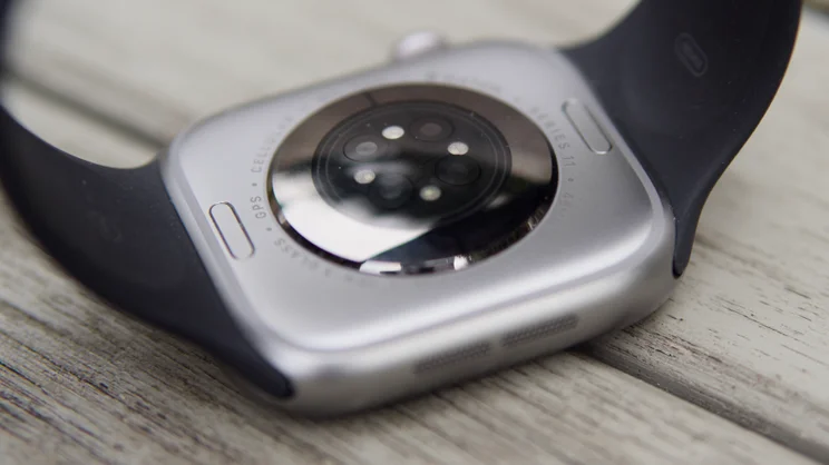 The Apple Watch Series 11 pictured from the rear