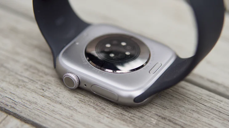 The Apple Watch Series 11 shown from the rear and right side