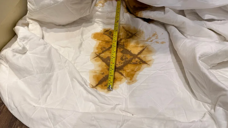 A closeup of a tape measure being used to measure the size of a coffee stain on a bedsheet