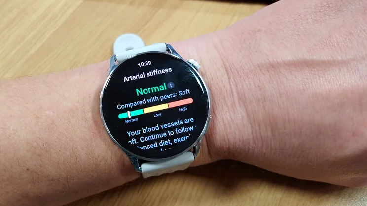 OnePlus Watch Lite on wrist, showing arterial stiffness results
